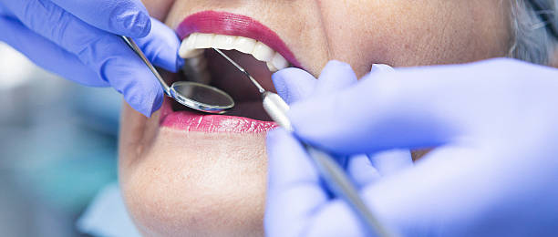 Best Emergency Tooth Extraction in Landis, NC